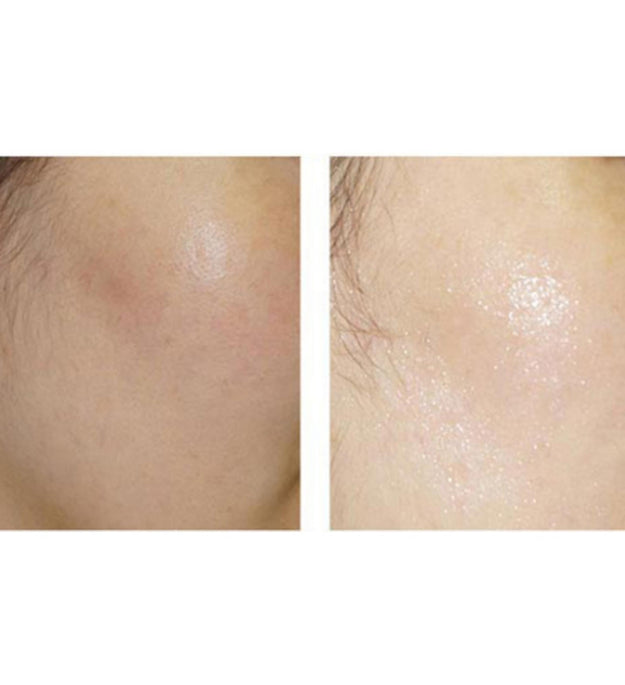 Pacote de Máscaras Eoseongcho Multi-Naturais