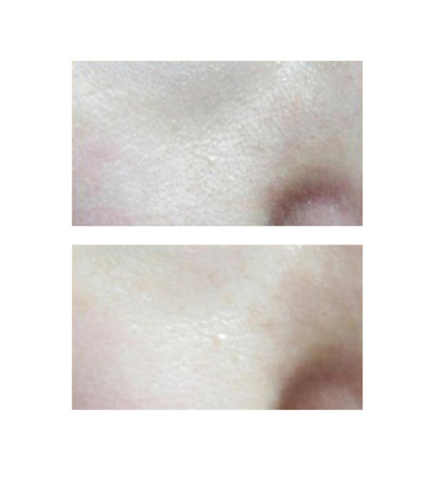 Skineye Natürliches fermentiertes Sanddornöl