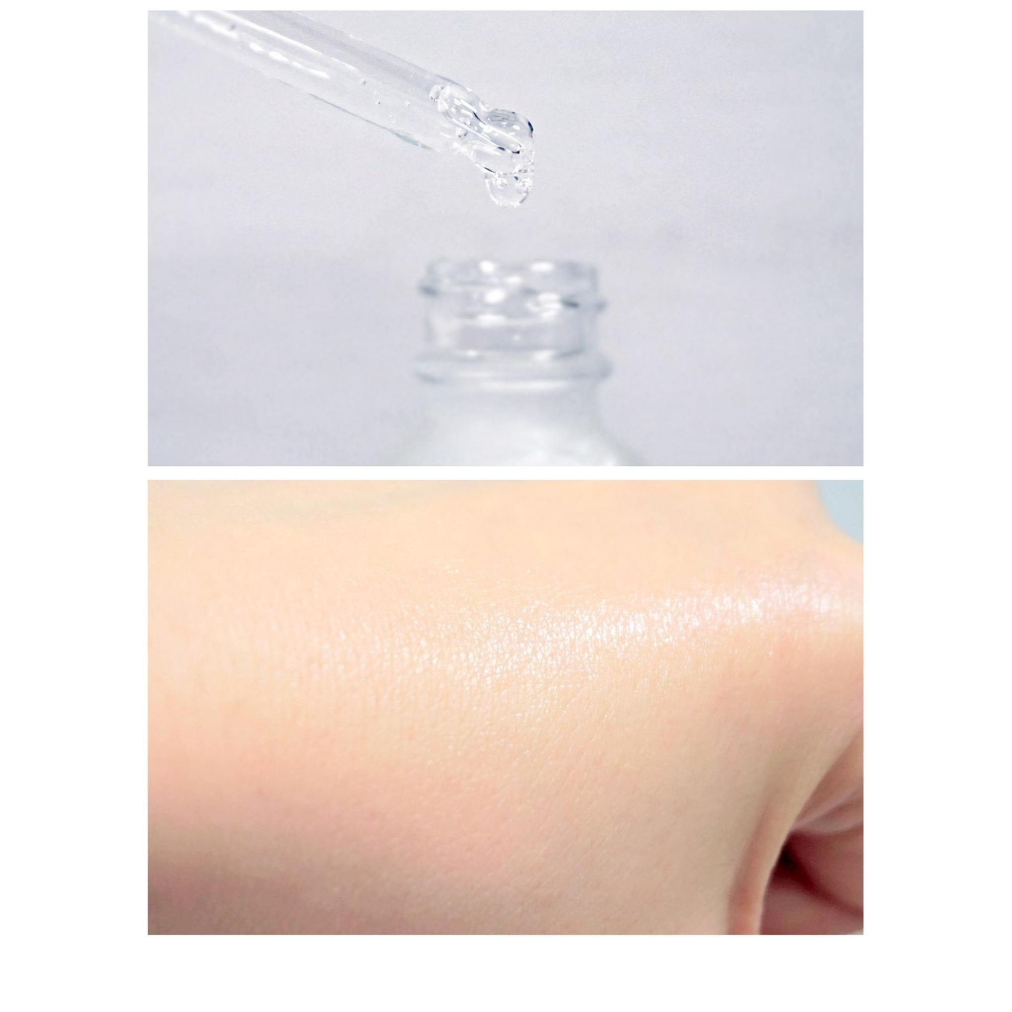 Siero Carenel Niacinamide Zinco Niacinamide 10% Cura Intensiva Illuminante