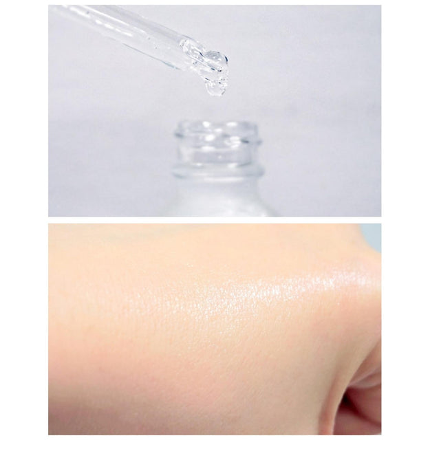 Carenel Niacinamide Zinc Serum Niacinamide 10% Cuidados Intensivos Iluminadores