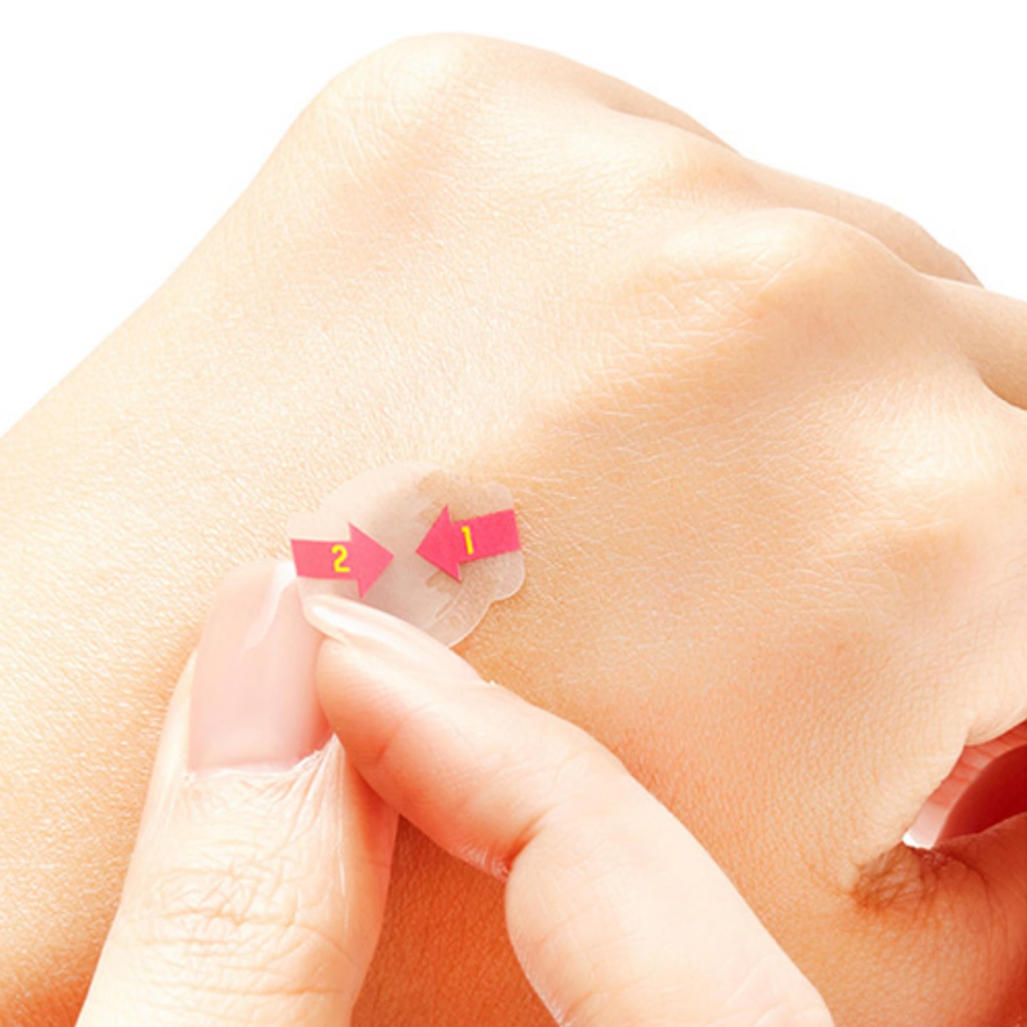 Catch Me Patch Trouble Spot Patch Yuvarlak 4 paket 240 yaprak 60 yaprak X 4 paket