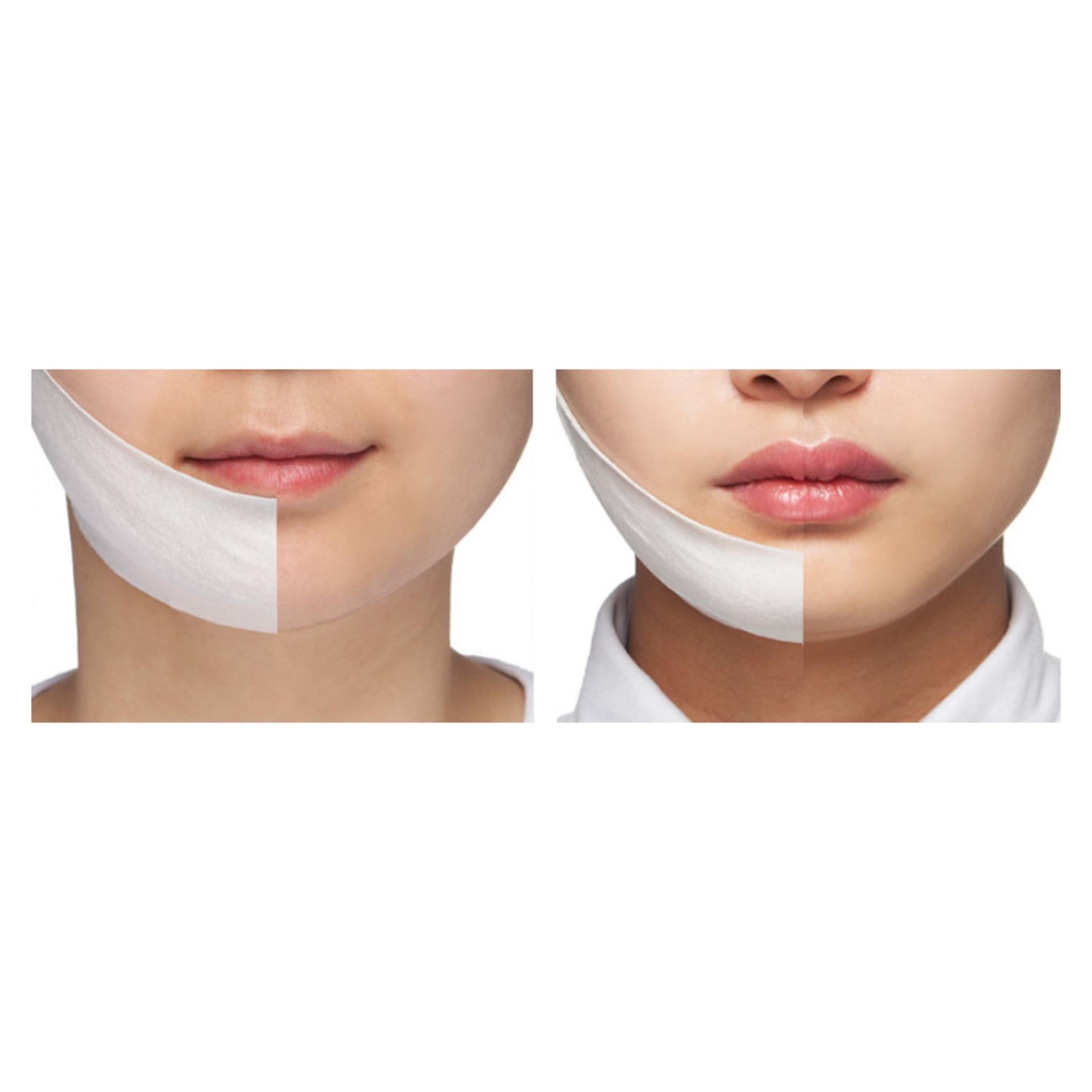 Paquete de elevación de coconeno V-Line de Muro Sleep