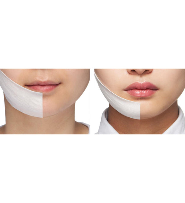 Pack de levage V-Line Coconene de Muro Sleep