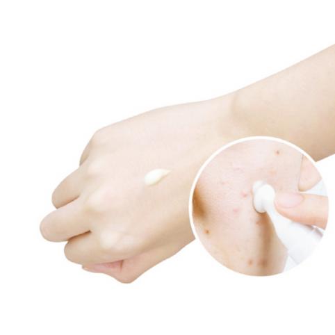 Yada Anti-T Red Zero Spot Cream