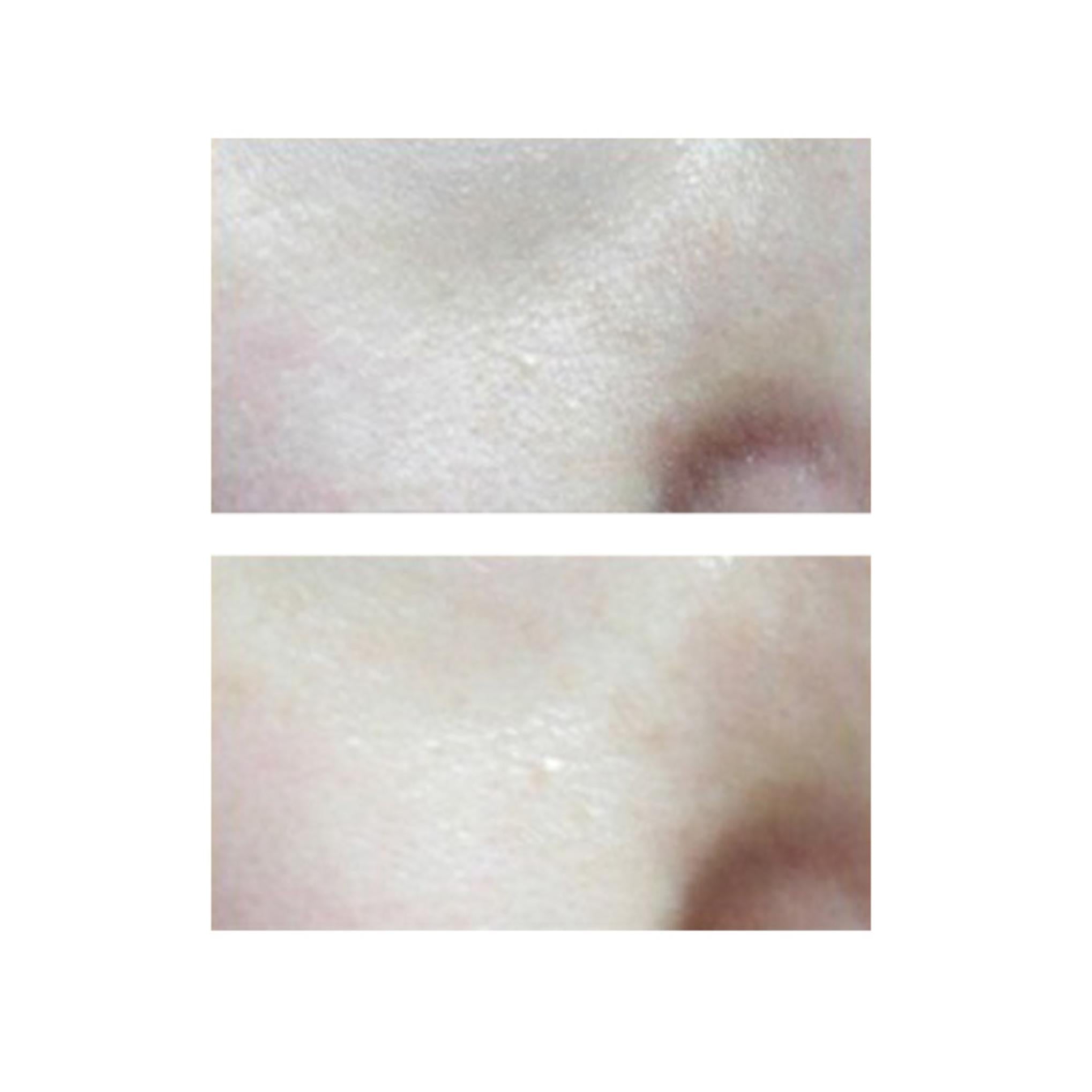 Skineye Натуральное ферментированное облепиховое масло