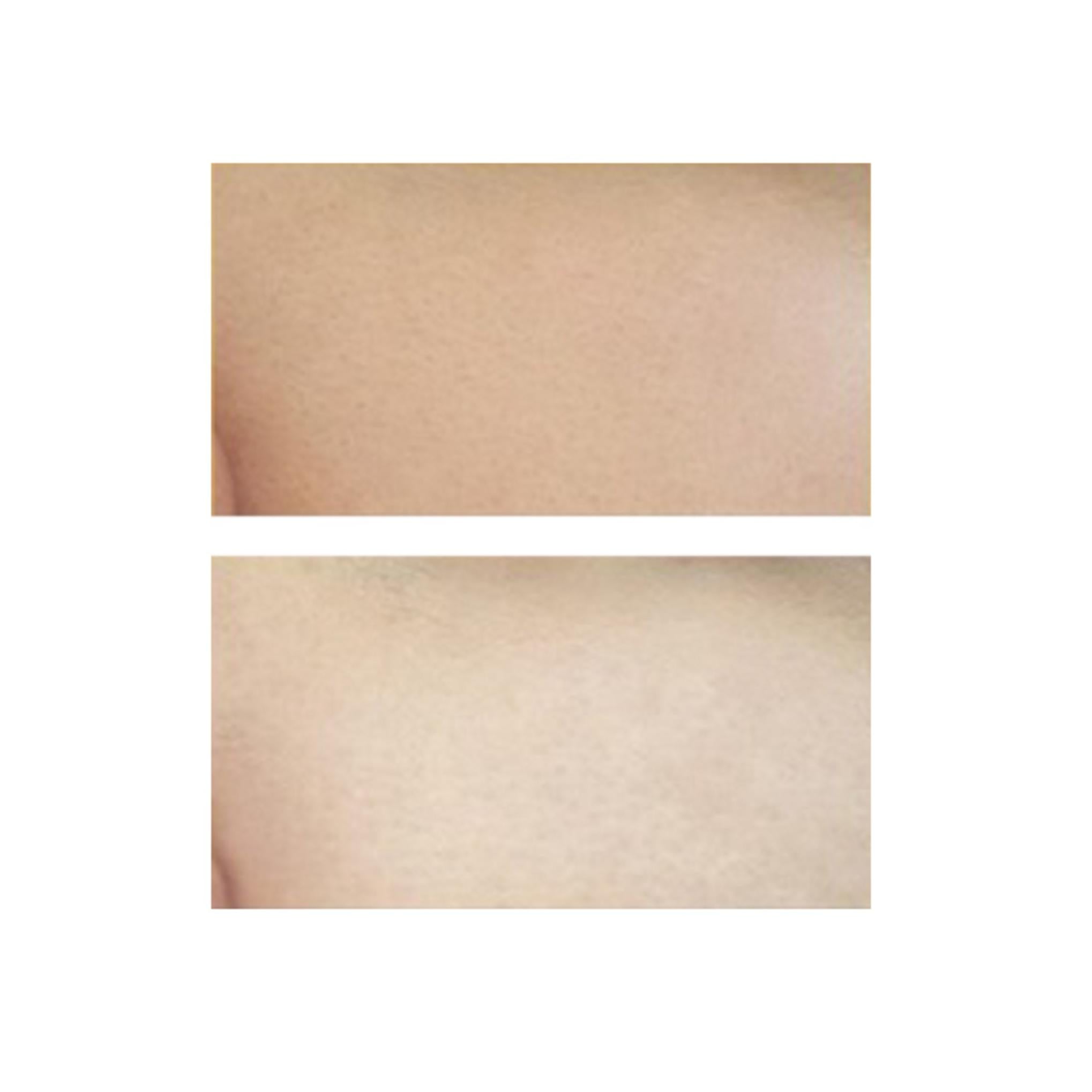 Skineye Натуральное ферментированное облепиховое масло