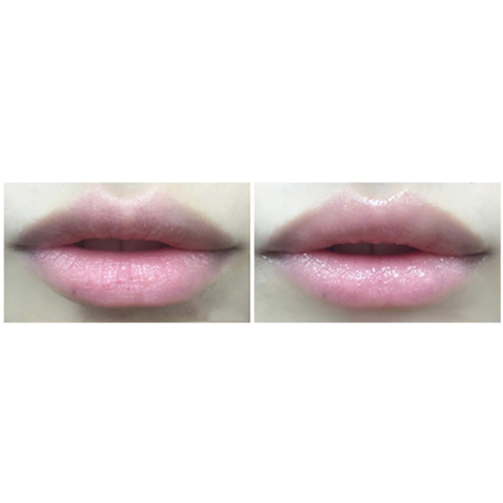 Balsamo labbra Isoi Sensitive Moisture 5g + Gel Moisture Tank 7ml