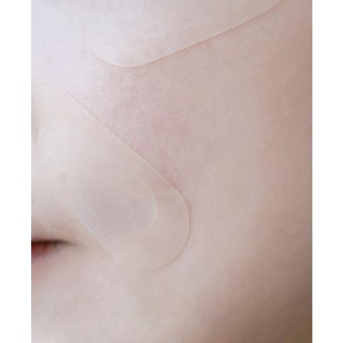 S&P Gold Collagen Nadelpflaster